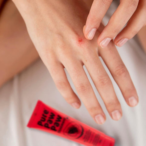 Pure Paw Paw Original Ointment – 25g | Multi-Purpose Balm for Lips, Dry Skin & More